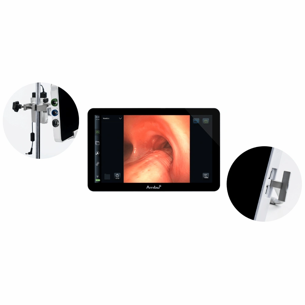 Màn hình nội soi phế quản Ambu aView 2 Advance