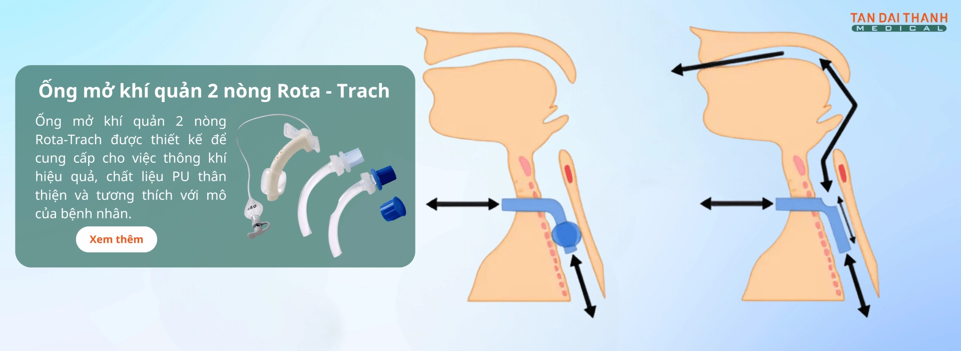 Ống mở khí quản